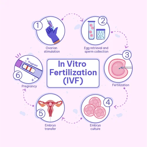 IVF pregnancy