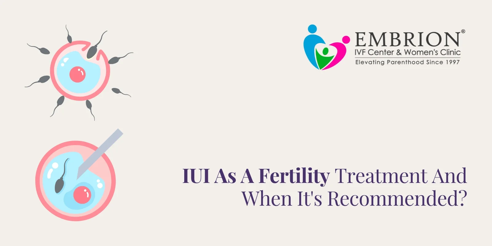 iui as a fertility treatment